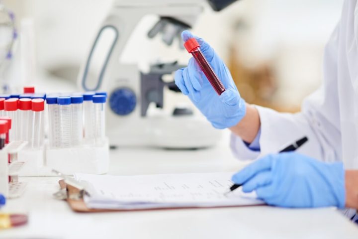 biaya tes laboratorium